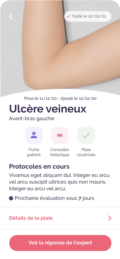 Illustration de l'application Avisplaie